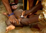 Mutilations génitales féminines : Il faut y mettre fin d'ici à 2030 selon l'UNFPA et l'UNICEF