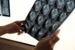Centre hospitalier régional de Dori : Quand va-t-on ressusciter le service de la radiologie pour soulager les malades et leurs proches ?